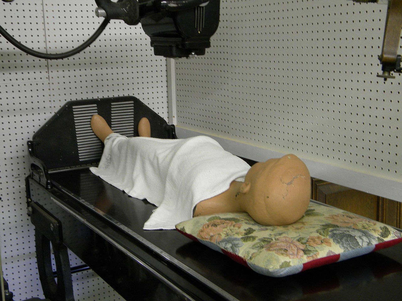 最新痔疮手术技术引领治疗格局变革